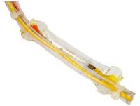 Amica Thermosicherungen                                            1034948